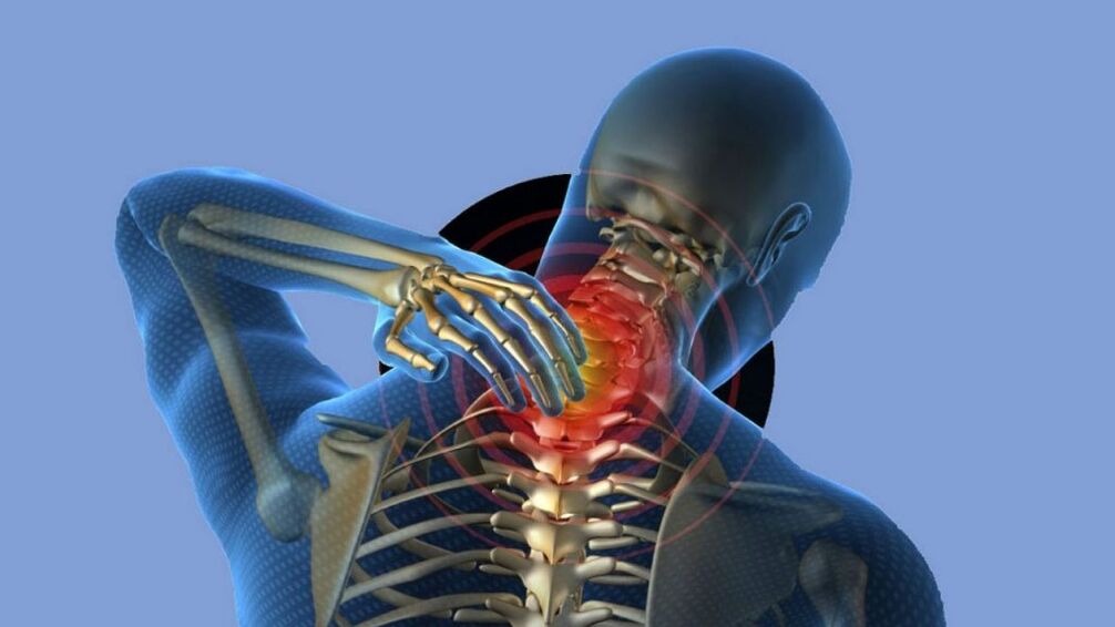 Osteochondrosis in the cervical region