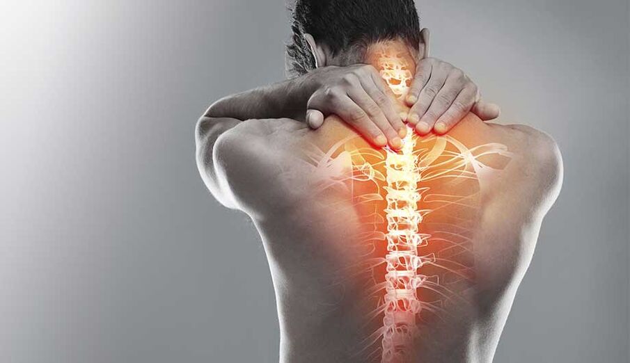 Osteocondrosis in the neck