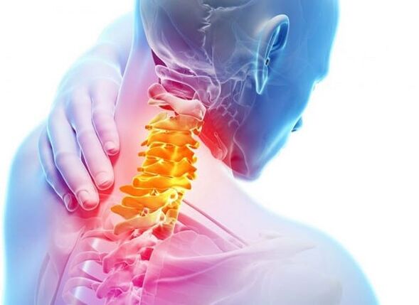 Osteochondrosis of the spine of the cervix