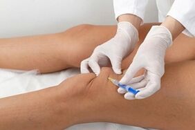 injections in the knee joint for osteoarthritis