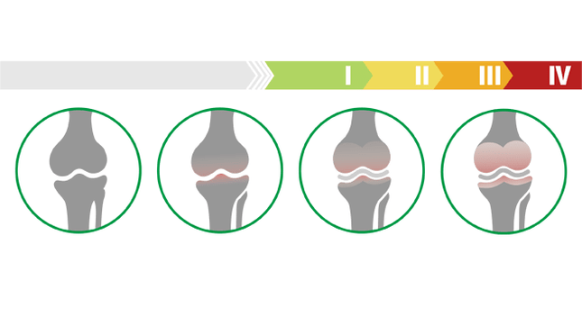 stages of atrophy